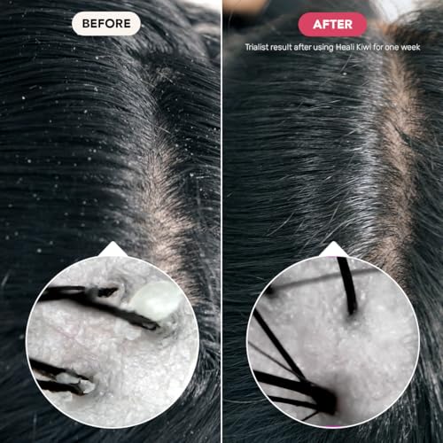 Cruelty-Free & Eco-Friendly Calming Shampoo Bar for Dry, Itchy Scalp